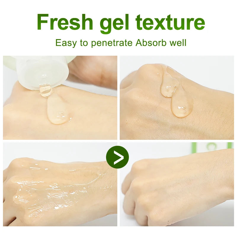 Aloe Vera Gel Sunburn Repairing Treatment Cream