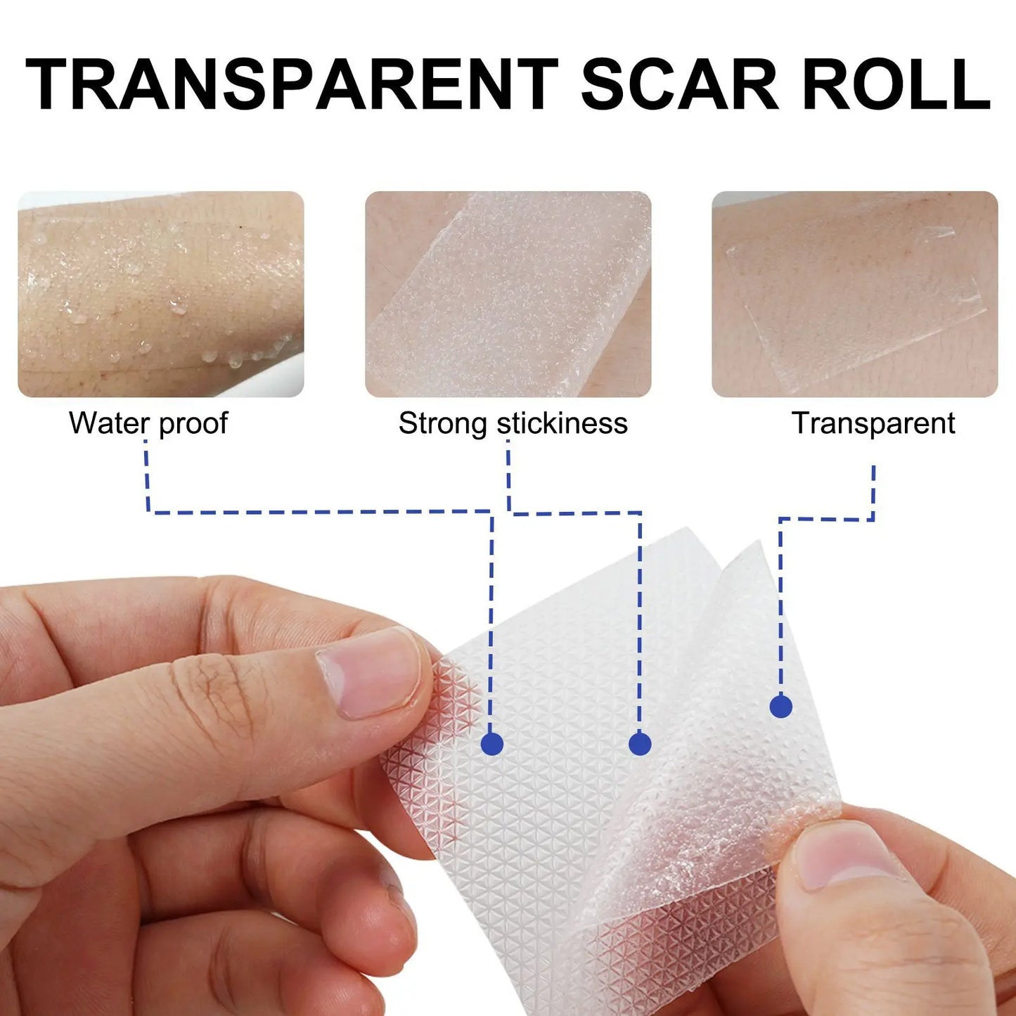 1/2Rolls Invisible Silicone Scar Sheets