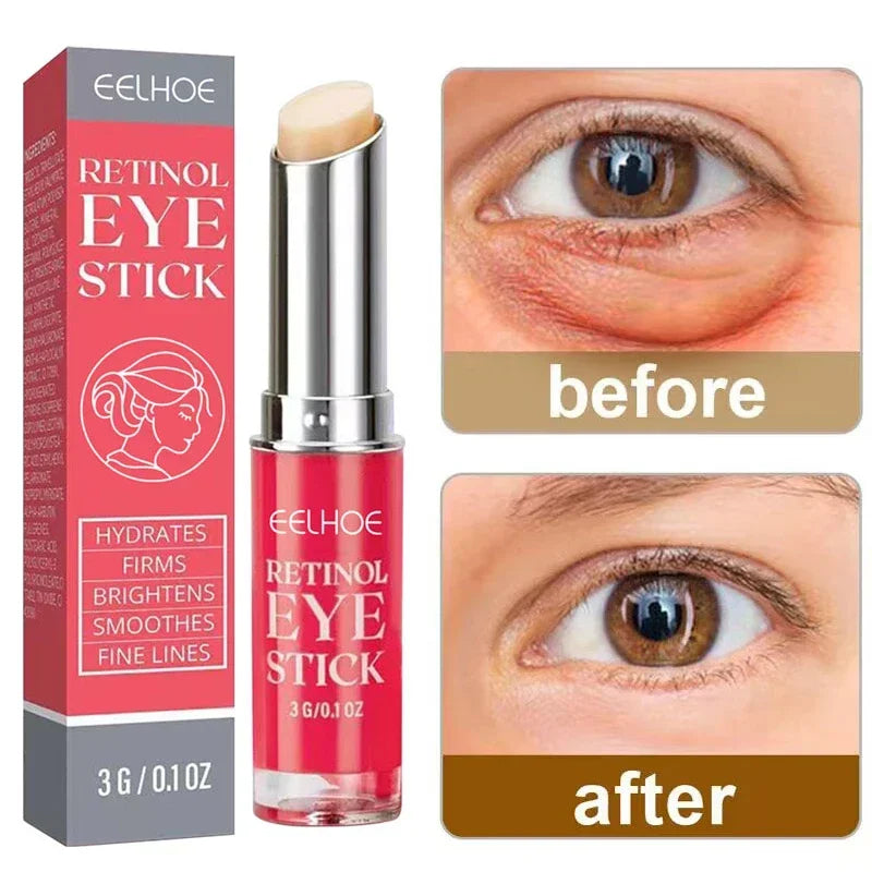 Anti-Wrinkle Eye Cream Retinol Remove Dark Circles