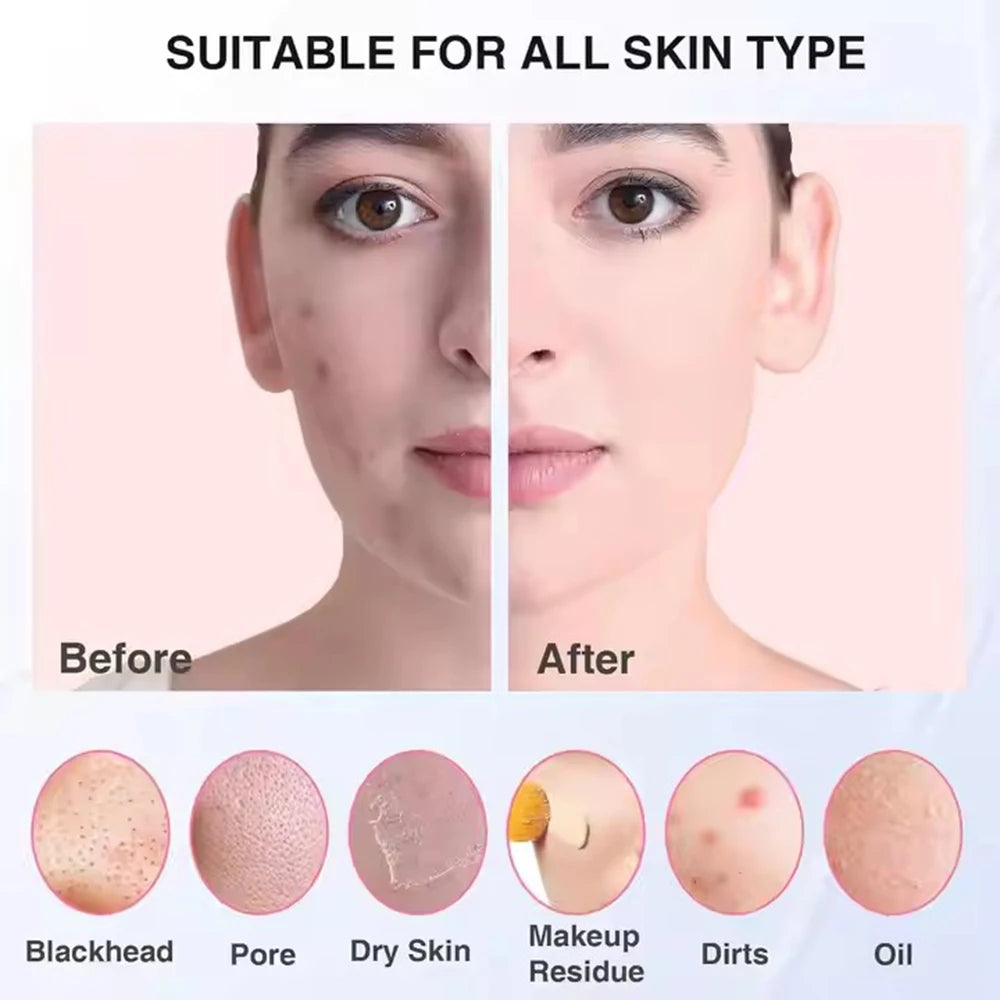 NEW Sonic Waterproof Facial Cleansing Brush for Men & Women Rechargeable Exfoliating Electric Face Scrubber Cleanser Brush