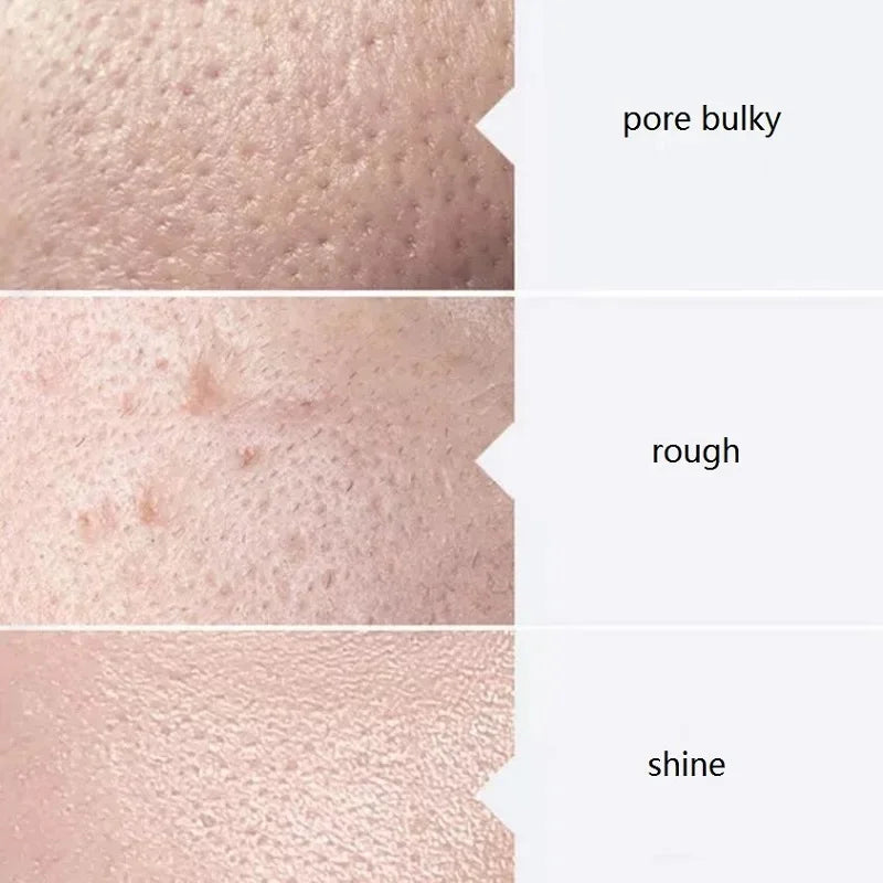 Facial Skincare Face Serum Aqua Peel Solution