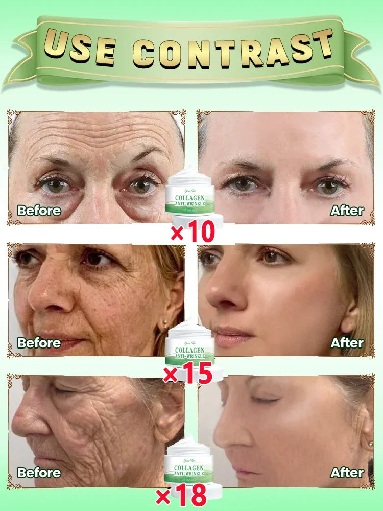 Anti wrinkles Anti Aging Cream