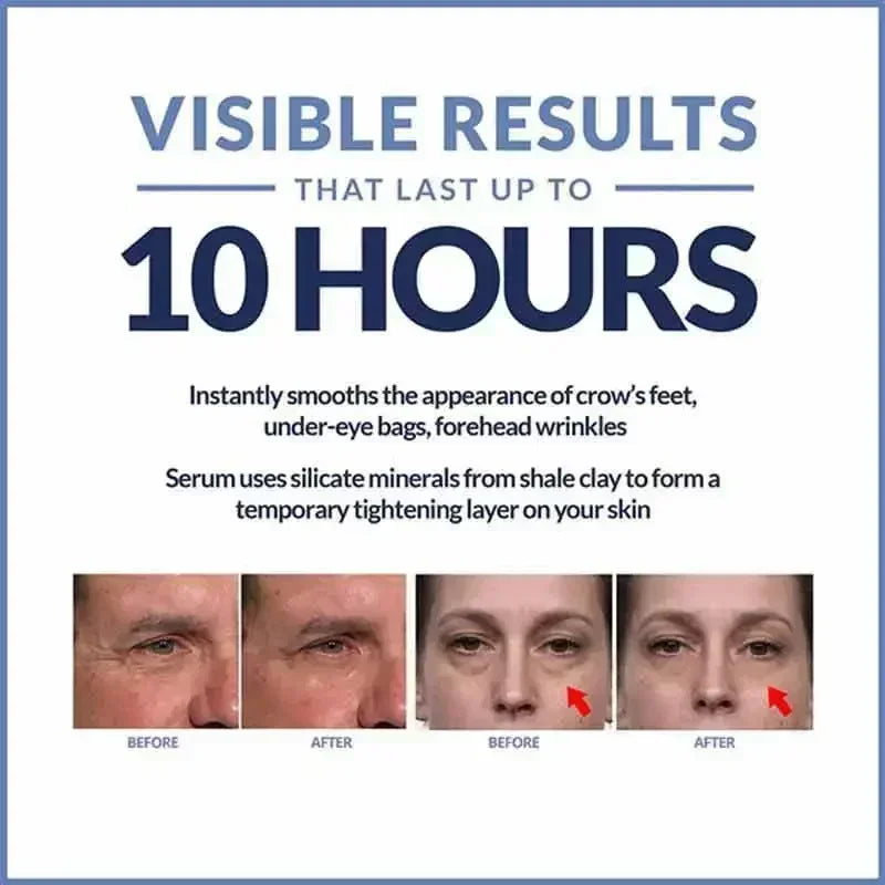 Instant Eye Cream For Anti Aging Dark Circles Bags