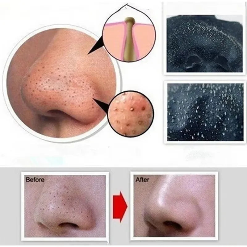 Blackhead Remover Charcoal Peel Off Mask