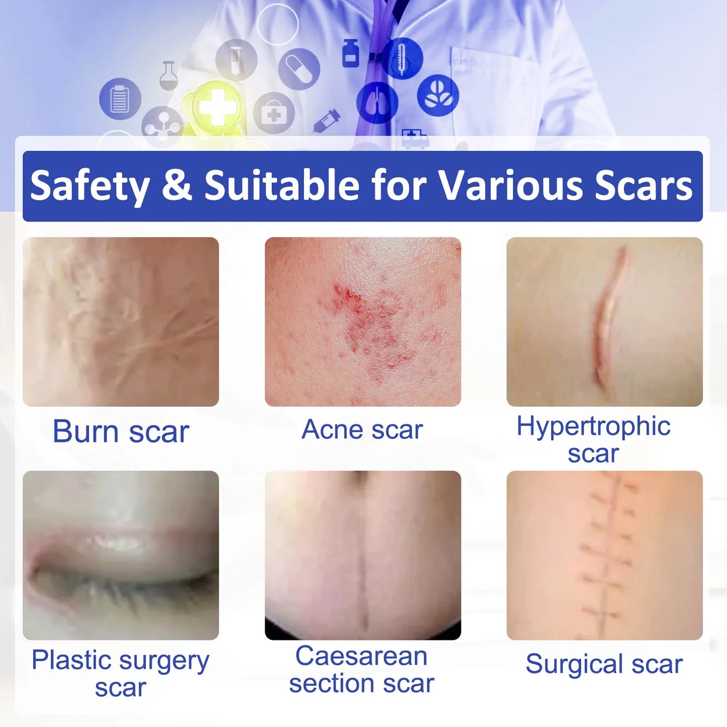1/2Rolls Invisible Silicone Scar Sheets