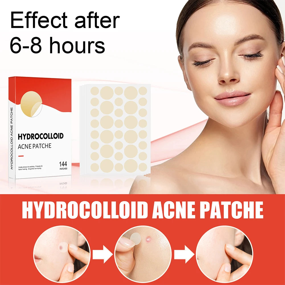 144 pcs/set Face Skin Care Acne Pimple Patch