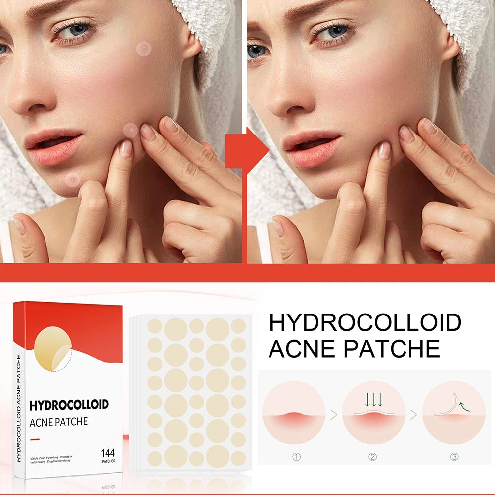 144 pcs/set Face Skin Care Acne Pimple Patch
