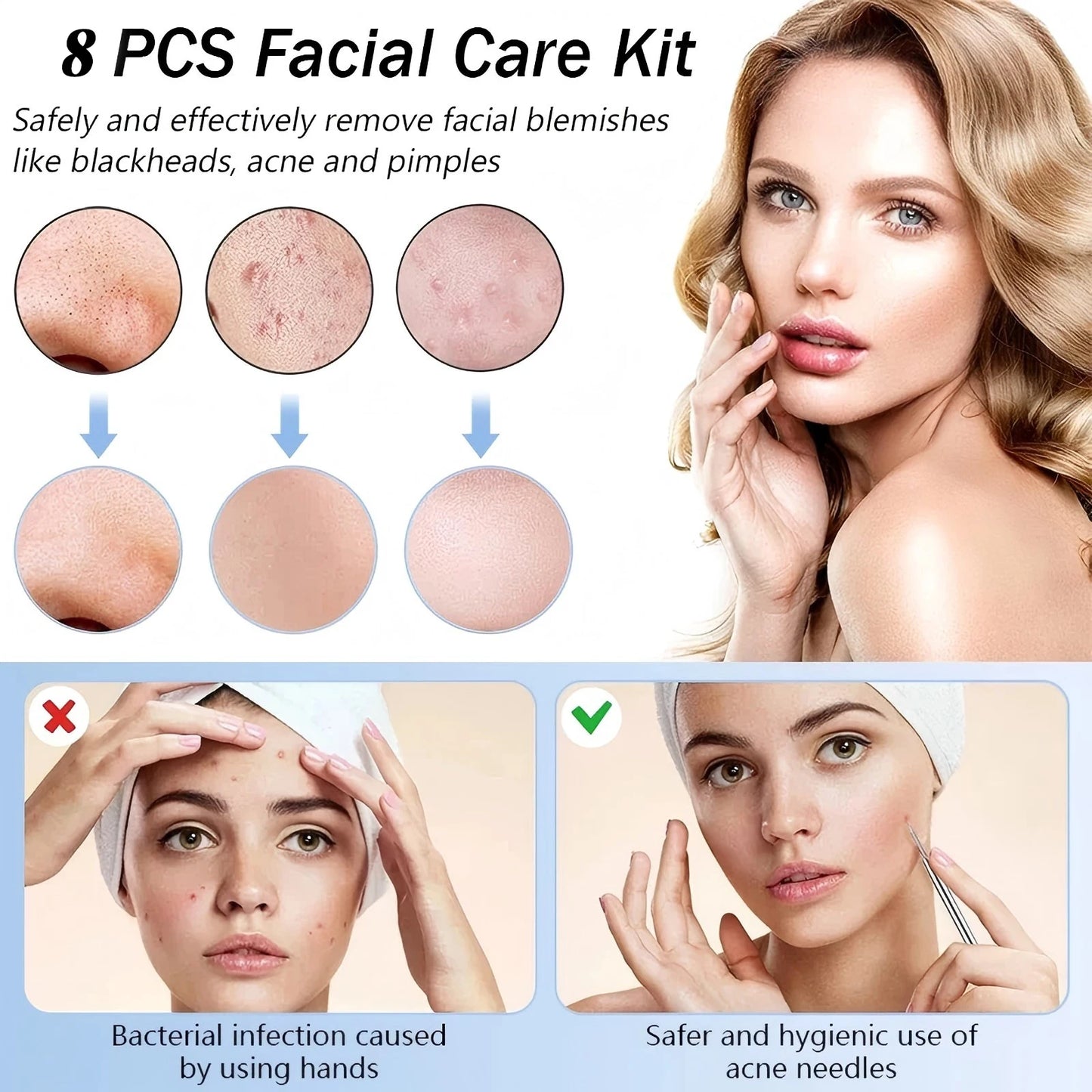 Stainless Steel Blackhead Removal Kit, Blemish and Acne Bottle Tool for All Skin Types, 8-Pack